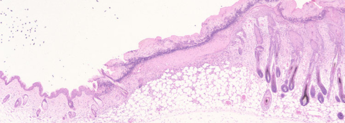 Main 002 ahr  null mutant index